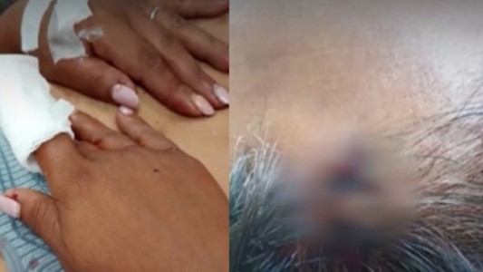 Torturaron a una mujer y le arrancaron el dedo para robarle