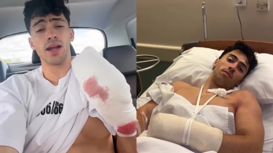 El influencer "de las dominadas", Gero Arias, sufrió un grave accidente: podría perder dos de sus dedos