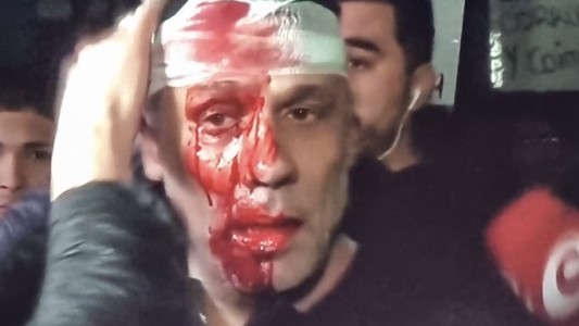 Tremenda agresión a un periodista en el acto de Javier Milei en Moreno