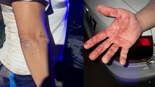 Agredieron a inspectores municipales tras intervenir en una fiesta por ruidos molestos