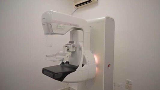 Presentaron un nuevo mamógrafo en el CEMAR