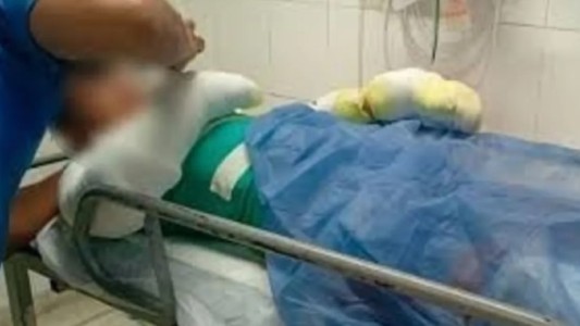 Córdoba: un adolescente sufrió quemaduras en el 60% de su cuerpo tras la explosión de su celular