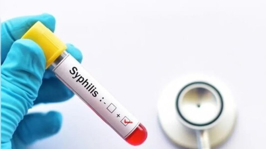 Alerta sanitaria: crece el número de casos de sífilis en Argentina