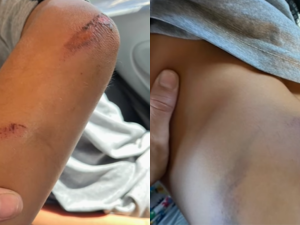 Carcarañá: una traveura terminó con un nene golpeado