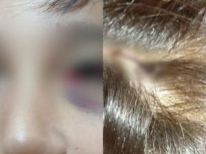 Mar del Plata: un alumno de 13 años fue apuñalado con una lapicera por un compañero en la escuela