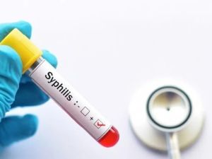 Preocupa el avance de la sífilis: fuerte suba de casos en el país