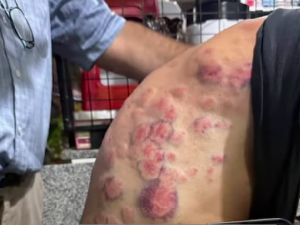 Ruta 9: un kinesiólogo sobrevivió a la feroz pedrada refugiado en su auto