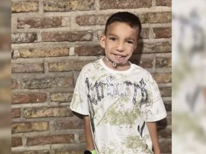 Bauti, un niño con Síndrome de Goldenhar, será operado nuevamente para favorecer el crecimiento de su mandíbula