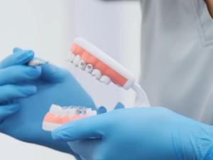 Alerta por intrusismo odontológico: advierten sobre falsos profesionales que realizan implantes