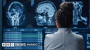 Qué sucede en el cerebro al morir: datos científicos que sorprenden