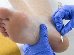 Cuando los pies hablan de nuestra salud: qué dolencias pueden detectarse a tiempo con una visita al podólogo