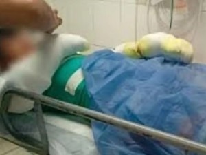 Córdoba: un adolescente sufrió quemaduras en el 60% de su cuerpo tras la explosión de su celular